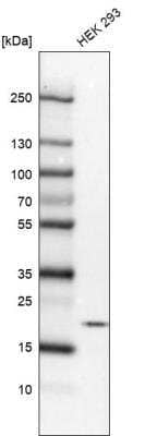 Western Blot: TTDN1 Antibody [NBP2-31718]