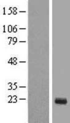 Western Blot: TTDN1 Overexpression Lysate [NBL1-08542]