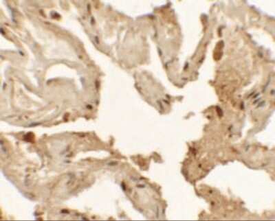 Immunohistochemistry: TTF-1 / NKX2-1 Antibody - BSA Free [NBP2-41160]