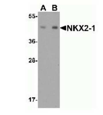 Western Blot: TTF-1 / NKX2-1 AntibodyBSA Free [NBP2-41160]