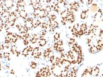 Immunohistochemistry-Paraffin: TTF-1 / NKX2-1 Antibody (8G7G3/1 + NX2.1/690) - Azide and BSA Free [NBP2-47773]