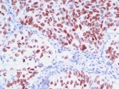 Immunohistochemistry-Paraffin: TTF-1 / NKX2-1 Antibody (8G7G3/1 + NX2.1/690) - Azide and BSA Free [NBP2-47773]