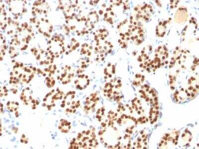 Immunohistochemistry-Paraffin: TTF-1 / NKX2-1 Antibody (8G7G3/1 + NX2.1/690) - IHC-Prediluted [NBP2-48118]