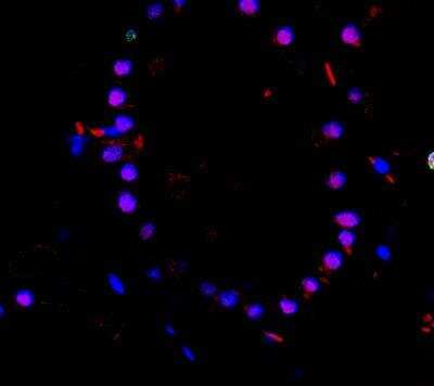 Immunohistochemistry: TTF-1 / NKX2-1 Antibody (8G7G3/1 + NX2.1/690) [NBP2-44501]