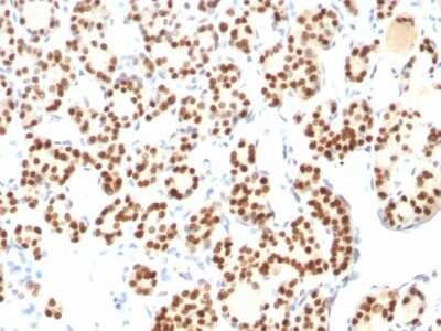 Immunohistochemistry-Paraffin: TTF-1 / NKX2-1 Antibody (8G7G3/1 + NX2.1/690) [NBP2-44501]