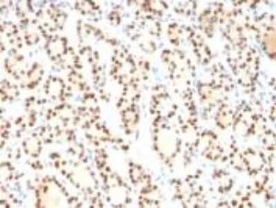 Immunohistochemistry-Paraffin: TTF-1 / NKX2-1 Antibody (8G7G3/1) - IHC-Prediluted [NBP2-48103]