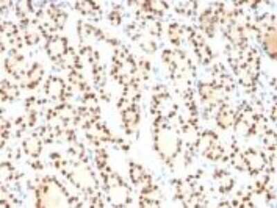 Immunohistochemistry-Paraffin: TTF-1 / NKX2-1 Antibody (8G7G3/1) [NBP2-44498]