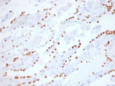 Immunohistochemistry-Paraffin: TTF-1 / NKX2-1 Antibody (NX2.1/1855R) - Azide and BSA Free [NBP3-08726]