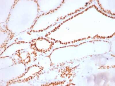 Immunohistochemistry-Paraffin: TTF-1 / NKX2-1 Antibody (NX2.1/1855R) [NBP3-07726]