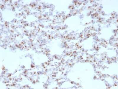 Immunohistochemistry-Paraffin: TTF-1 / NKX2-1 Antibody (NX2.1/690) - Azide and BSA Free [NBP2-47772]