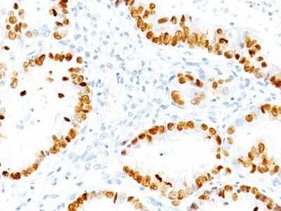 Immunohistochemistry-Paraffin: TTF-1 / NKX2-1 Antibody (NX2.1/690) - IHC-Prediluted [NBP2-48104]