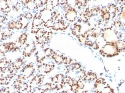 Immunohistochemistry-Paraffin: TTF-1 / NKX2-1 Antibody (NX2.1/690) - IHC-Prediluted [NBP2-48104]