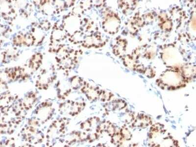 Immunohistochemistry-Paraffin: TTF-1 / NKX2-1 Antibody (NX2.1/690) [NBP2-44500]