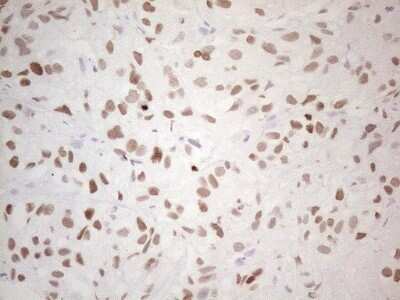 Immunohistochemistry: TTF-1 / NKX2-1 Antibody (OTI10F8) - Azide and BSA Free [NBP2-74667]