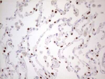 Immunohistochemistry: TTF-1 / NKX2-1 Antibody (OTI10F8) - Azide and BSA Free [NBP2-74667]