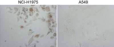 Immunohistochemistry: TTF-1 / NKX2-1 Antibody (OTI10F8) - Azide and BSA Free [NBP2-74667]