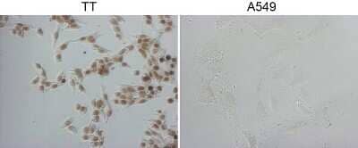 Immunohistochemistry: TTF-1 / NKX2-1 Antibody (OTI10F8) - Azide and BSA Free [NBP2-74667]