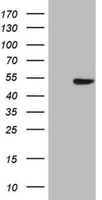 Western Blot: TTF-1 / NKX2-1 Antibody (OTI10F8)Azide and BSA Free [NBP2-74667]