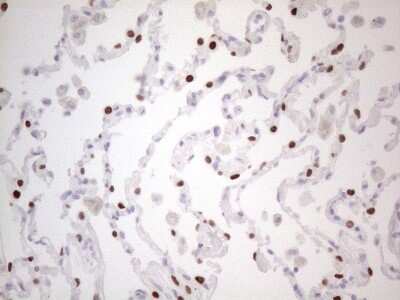 Immunohistochemistry: TTF-1 / NKX2-1 Antibody (OTI10F8) [NBP2-46175]