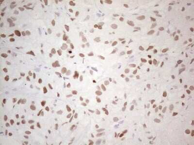 Immunohistochemistry: TTF-1 / NKX2-1 Antibody (OTI10F8) [NBP2-46175]