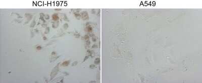 Immunohistochemistry-Paraffin: TTF-1 / NKX2-1 Antibody (OTI10F8) [NBP2-46175]