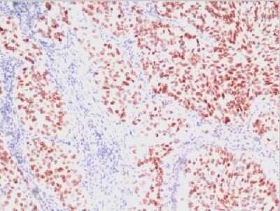 Immunohistochemistry-Paraffin: TTF-1 / NKX2-1 Antibody (SPM150) - Azide and BSA Free [NBP2-34742]