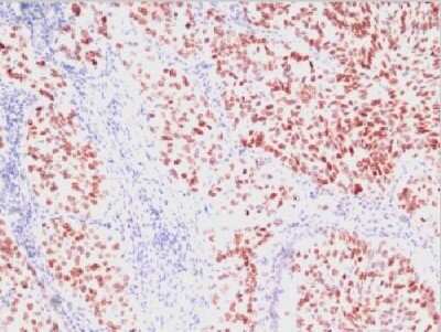 Immunohistochemistry-Paraffin: TTF-1 / NKX2-1 Antibody (SPM150) [NBP2-32999]