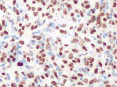 Immunohistochemistry-Paraffin: TTF-1 / NKX2-1 Antibody (SPM150) [NBP2-32999]