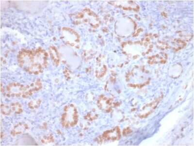 Immunohistochemistry-Paraffin: TTF-1 / NKX2-1 Antibody (rNX2.1/690) - Azide and BSA Free [NBP3-08725]