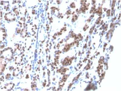 Immunohistochemistry-Paraffin: TTF-1 / NKX2-1 Antibody (rNX2.1/690) [NBP3-07725]