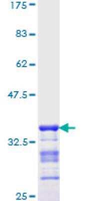 SDS-PAGE: Recombinant Human TTF-1 / NKX2-1 GST (N-Term) Protein [H00007080-Q01]