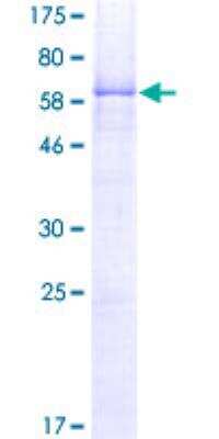 SDS-PAGE: Recombinant Human TTF-1 / NKX2-1 GST (N-Term) Protein [H00007080-P01]