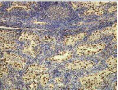 Immunohistochemistry-Paraffin: TTF-1 / NKX2-1 Antibody (G21-G) [NBP1-79056]