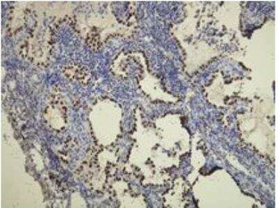 Immunohistochemistry-Paraffin: TTF-1 / NKX2-1 Antibody (G21-G) [NBP1-79056]