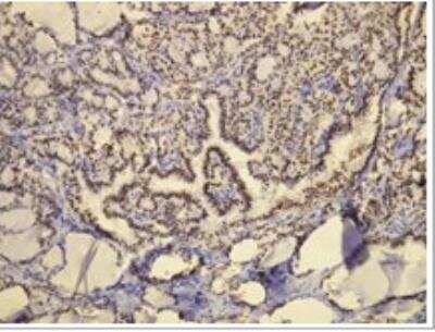 Immunohistochemistry-Paraffin: TTF-1 / NKX2-1 Antibody (G21-G) [NBP1-79056]