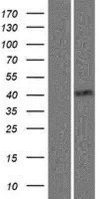 Western Blot: TTF-1 / NKX2-1 Overexpression Lysate [NBP2-11446]