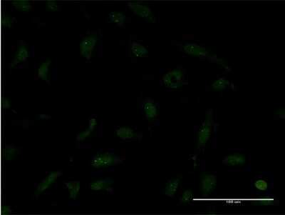 Immunocytochemistry/ Immunofluorescence: TTF2 Antibody (1E8) [H00008458-M06]