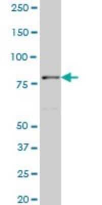 Western Blot: TTF2 Antibody (1E8) [H00008458-M06]