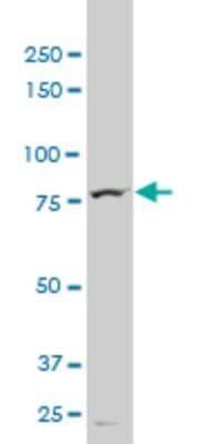 Western Blot: TTF2 Antibody (3D11) [H00008458-M02]