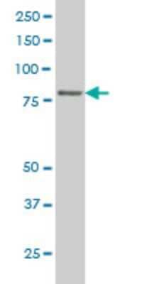 Western Blot: TTF2 Antibody (3F7) [H00008458-M09]