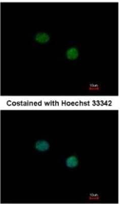 Immunocytochemistry/ Immunofluorescence: TTF2 Antibody [NBP1-32842]