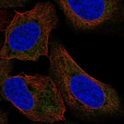 Immunocytochemistry/ Immunofluorescence: TTF2 Antibody [NBP2-57736]