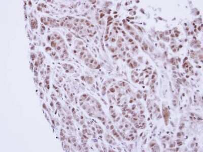 Immunohistochemistry-Paraffin: TTF2 Antibody [NBP1-32842]