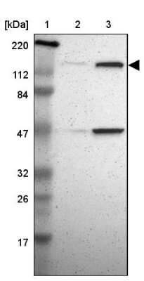 Western Blot: TTF2 Antibody [NBP1-83148]