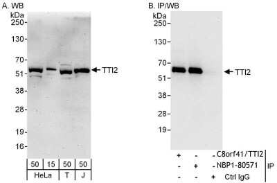 Immunoprecipitation: TTI2 Antibody [NBP1-80571]