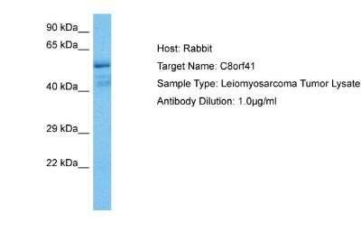 Western Blot: TTI2 Antibody [NBP2-88512]