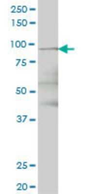 Western Blot: TTK Antibody (2F1) [H00007272-M04]