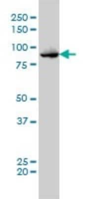 Western Blot: TTK Antibody (3G7) [H00007272-M01]