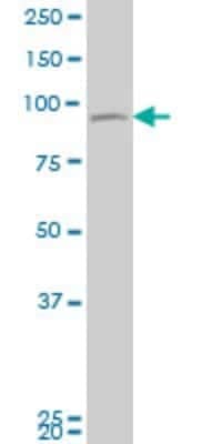 Western Blot: TTK Antibody (4G9) [H00007272-M02]