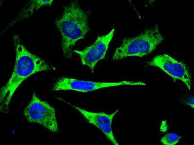 Immunocytochemistry/ Immunofluorescence: TTK Antibody [NBP2-98832]